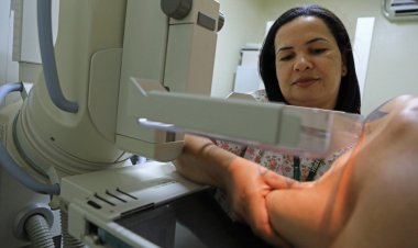 Realização de mamografias na Região Nordeste está 50,1