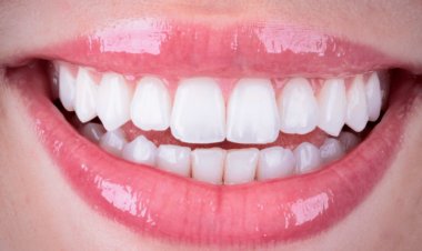 Dor aguda nos dentes: especialista explica causas e como aliviar os sintomas