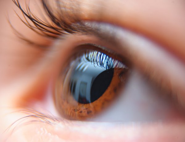 Ceratocone cresce entre jovens, afeta mais de 150 mil brasileiros e acende alerta entre especialistas