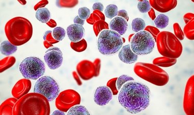 Quando o câncer do sangue não dá sinais: o desafio das leucemias crônicas